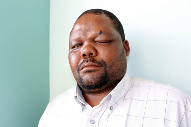 Thandolwethu Gebengana was assaulted at a Wells Estate ANC branch meeting on October 7 2018.